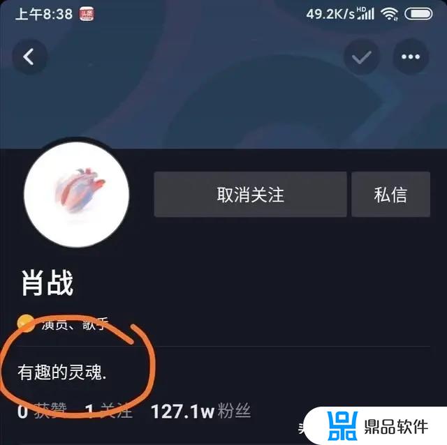 抖音里为什么都是夸肖战(抖音里为什么都是夸肖战的)