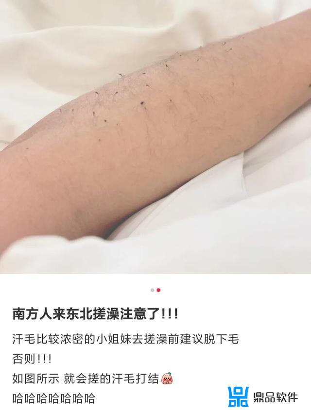 抖音搓腿毛视频(经常搓腿毛会不会不长)