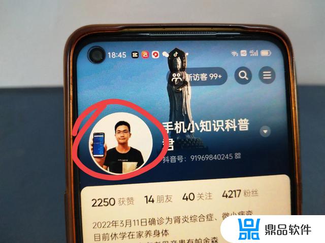 为什么抖音多选发影集照片不翻动(为什么抖音多选发影集照片不翻动了)