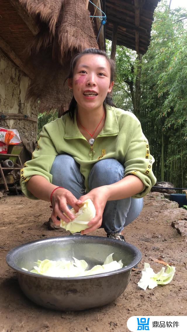 抖音祛胎记怎么祛的(怎么样可以祛胎记)