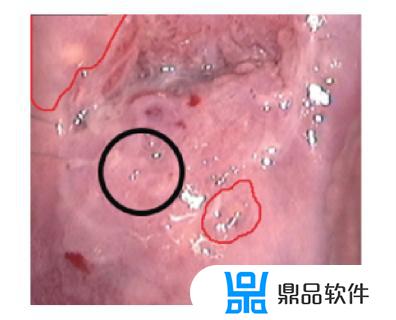 抖音单反采集卡直播怎么扣绿布