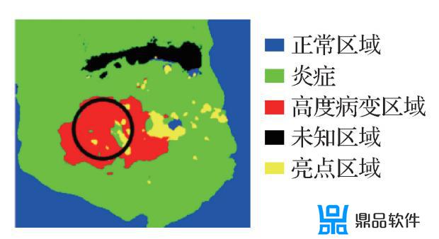 抖音单反采集卡直播怎么扣绿布