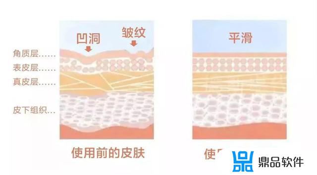 抖音去法令纹的面膜怎么用(面膜可以去法令纹吗)