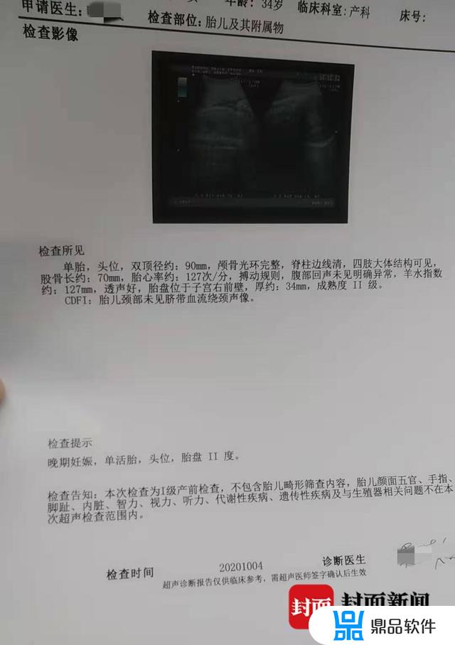 为什么看抖音宝宝一直有胎动(宝宝有时候胎动像发抖一样正常吗)