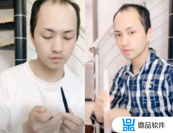 抖音秃顶男图片(抖音秃头男)