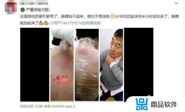 抖音上治疗腰突的喷剂怎么样