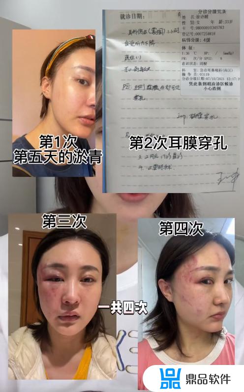 抖音被家暴的女人怎么样啦(抖音被家暴的女人怎么样了)