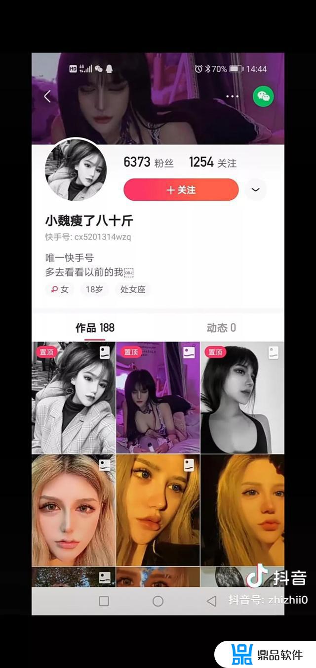 抖音整容女秀恩爱(抖音上的整容女)