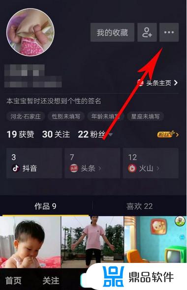 抖音的联系人好友怎么取消vivo(怎么取消抖音最近联系人)