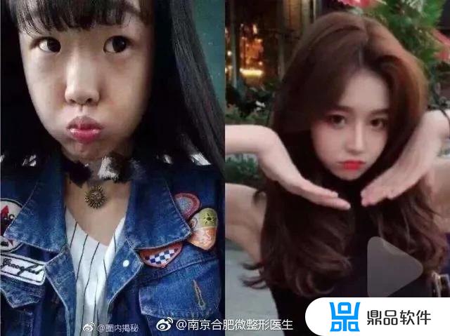 抖音为什么不可以美颜瘦脸(抖音为什么不可以美颜瘦脸了)