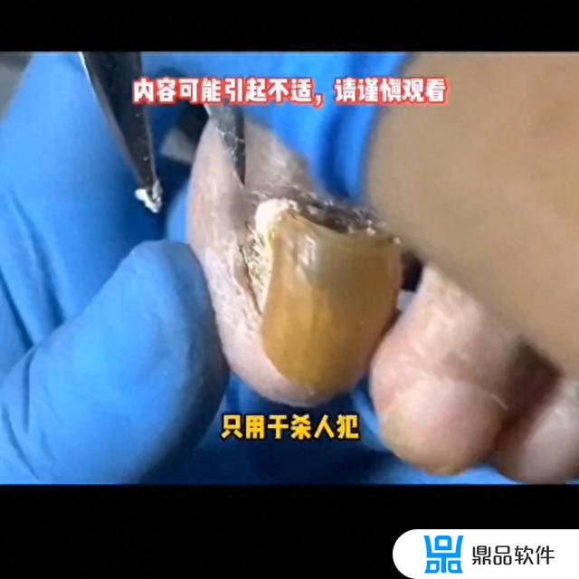 抖音快看看小程序入口(抖音快看看小程序入口怎么关闭)