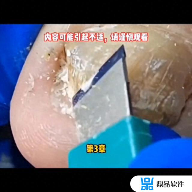 抖音快看看小程序入口(抖音快看看小程序入口怎么关闭)